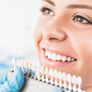 evolution des teintes d'un blanchiment dentaire
